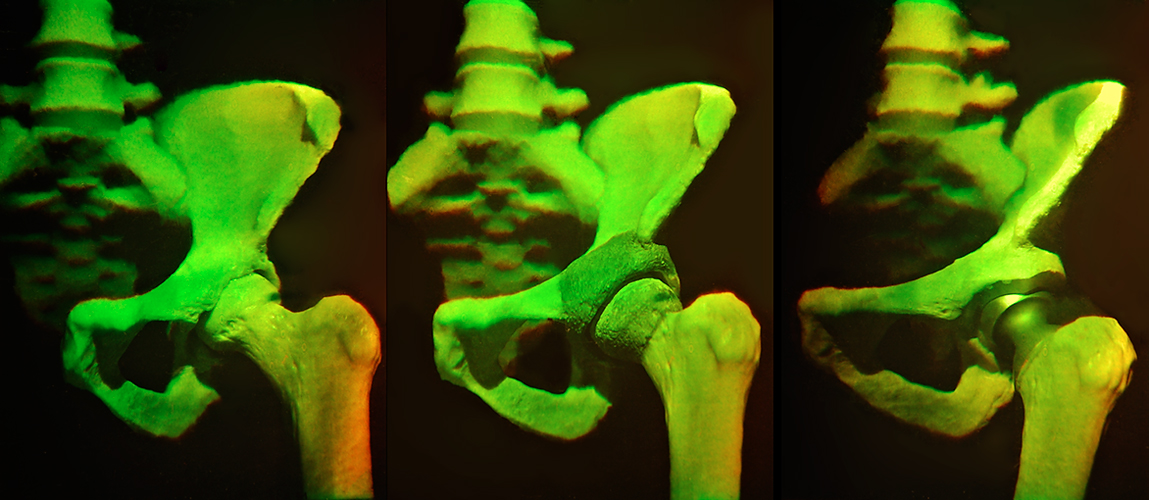 Auch 'ne Art von Stereo